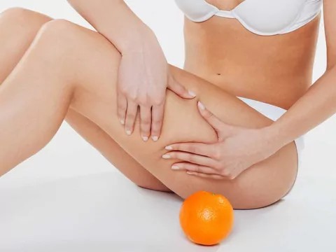 Dieta antycellulitowa: działanie i jadłospis