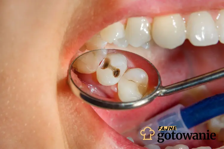 Jama ustna, w której znajduje się lustereczko dentystyczne, w którym pokazana jest próchnica zębów, a także co powoduje codzienne picie coca-coli