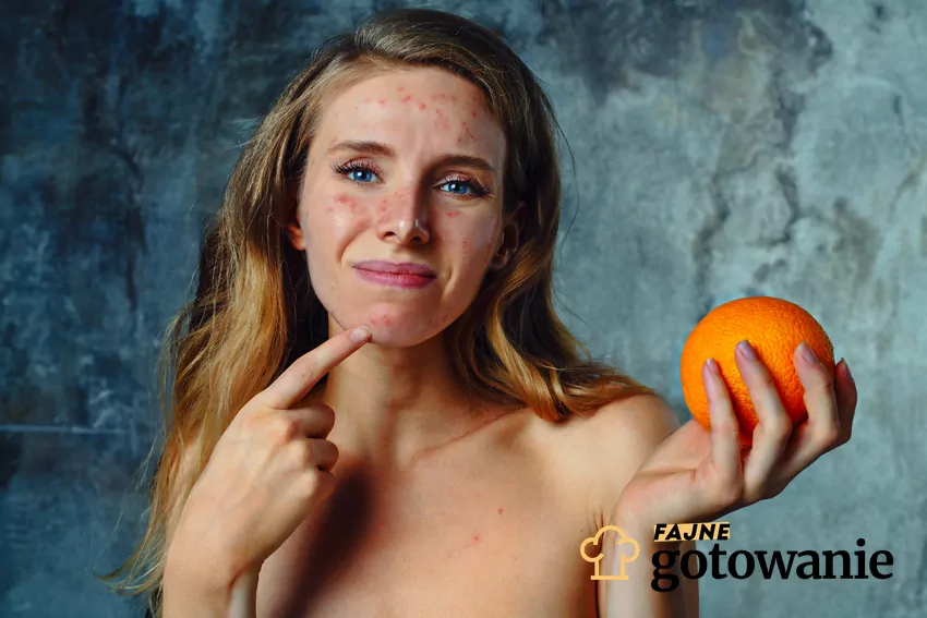 Najlepsza dieta na trądzik, czyli skuteczność, zasady i lista zalecanych produktów przeciw trądzikowi Kobieta z trądzikiem, a także dieta na trądzik i jej zasady, skuteczność i przykładowe menu